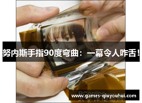 努内斯手指90度弯曲:一幕令人咋舌!